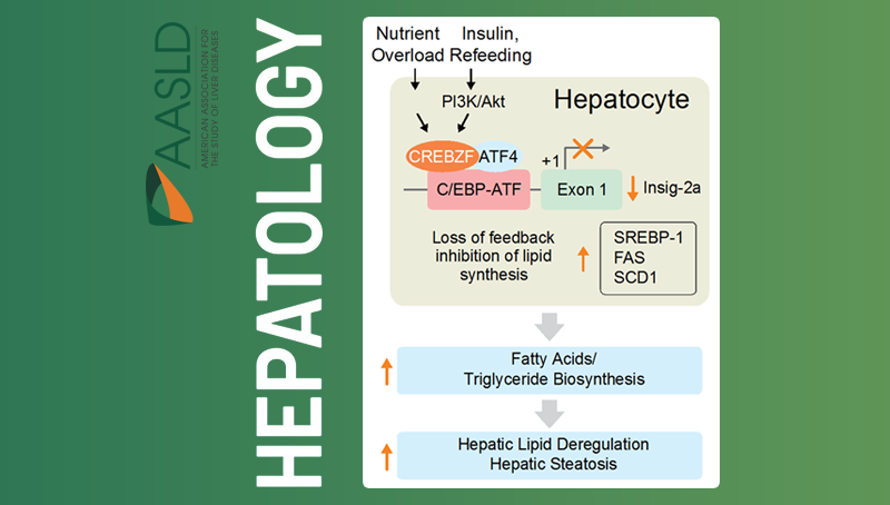李于研究組發(fā)現(xiàn)治療非酒精性脂肪肝合并胰島素抵抗的新靶點