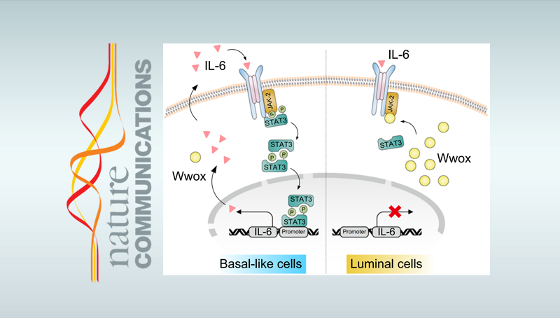 詹麗杏研究組發(fā)現(xiàn)三陰性乳腺癌治療新靶標