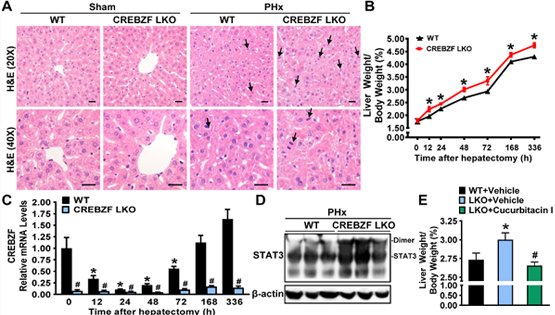李于研究組發(fā)現(xiàn)CREB/ATF堿性亮氨酸拉鏈轉(zhuǎn)錄因子調(diào)控肝臟組織再生的新機制