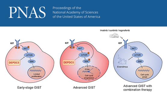 王躍祥研究組合作發(fā)現(xiàn)胃腸道間質(zhì)瘤惡性進(jìn)展的新機(jī)制