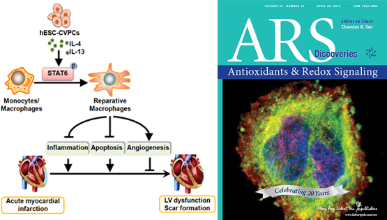 楊黃恬研究組揭示人胚胎干細(xì)胞（hESCs）來源的心血管前體細(xì)胞（CVPCs）移植對(duì)急性心肌梗死的保護(hù)作用