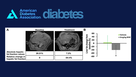 中國科學院上海營養(yǎng)與健康研究所與天士力生物合作發(fā)表新型FGF21類似物治療非人靈長類動物非酒精性脂肪性肝炎的研究成果