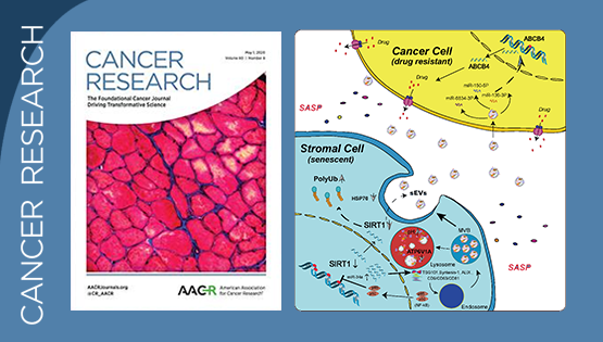 孫宇研究組發(fā)現(xiàn)衰老細(xì)胞衍生小胞外囊泡并引發(fā)微環(huán)境中癌細(xì)胞獲得性耐藥的關(guān)鍵機(jī)制
