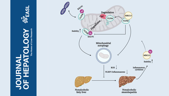 營養(yǎng)與健康所丁秋蓉研究組發(fā)現(xiàn)治療非酒精性脂肪肝炎的潛在新靶點