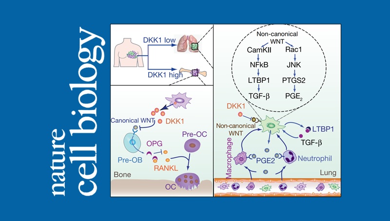 中國科學(xué)院上海營養(yǎng)與健康研究院研究人員在腫瘤器官特異性轉(zhuǎn)移研究中取得重要進展