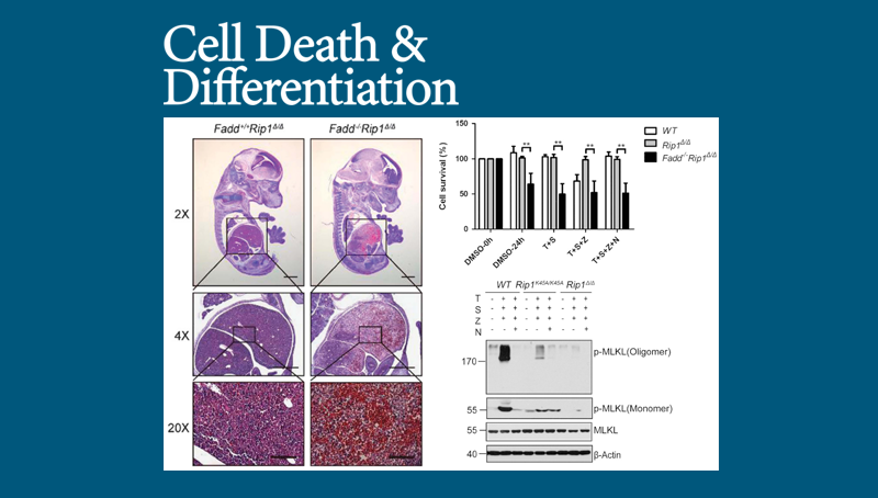 中國科學(xué)院上海營養(yǎng)與健康研究院科研人員揭示細胞生死的關(guān)鍵調(diào)控因子RIP1的激酶活性作用機制
