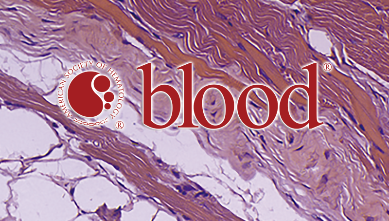 中國科學(xué)院上海營養(yǎng)與健康研究院科研人員揭示Hsp90調(diào)控Ezh2蛋白穩(wěn)定性參與移植物抗宿主病的重要機制