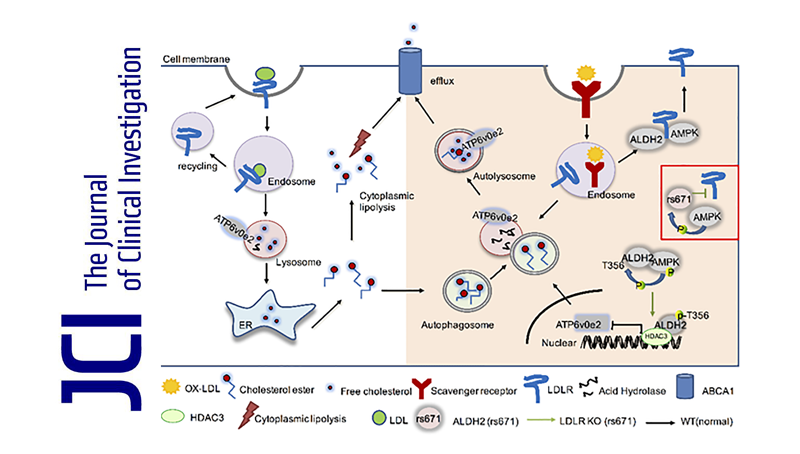 尹慧勇研究組發(fā)現(xiàn)乙醛脫氫酶2調(diào)控動脈粥樣硬化的新機制