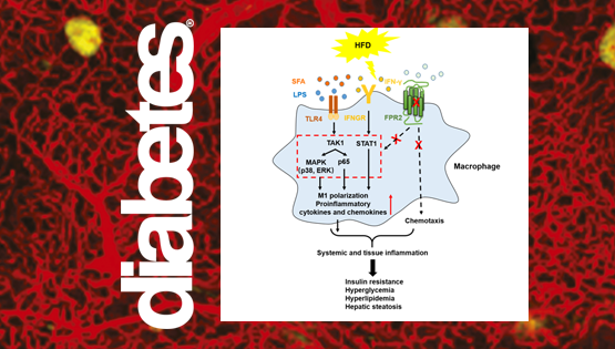 樂(lè)穎影研究組發(fā)現(xiàn)高脂飲食導(dǎo)致肥胖和糖脂代謝紊亂的新機(jī)制