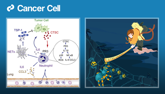 胡國宏研究組發(fā)現(xiàn)乳腺癌肺轉(zhuǎn)移調(diào)控的新機(jī)制
