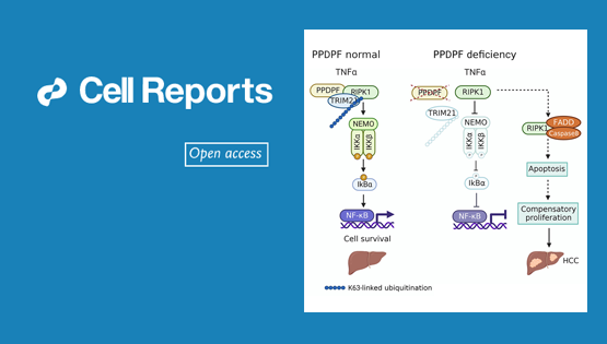 營(yíng)養(yǎng)與健康所謝東研究組揭示PPDPF調(diào)控肝癌的新機(jī)制